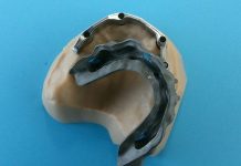 Progetto barra cad con frizioni LV