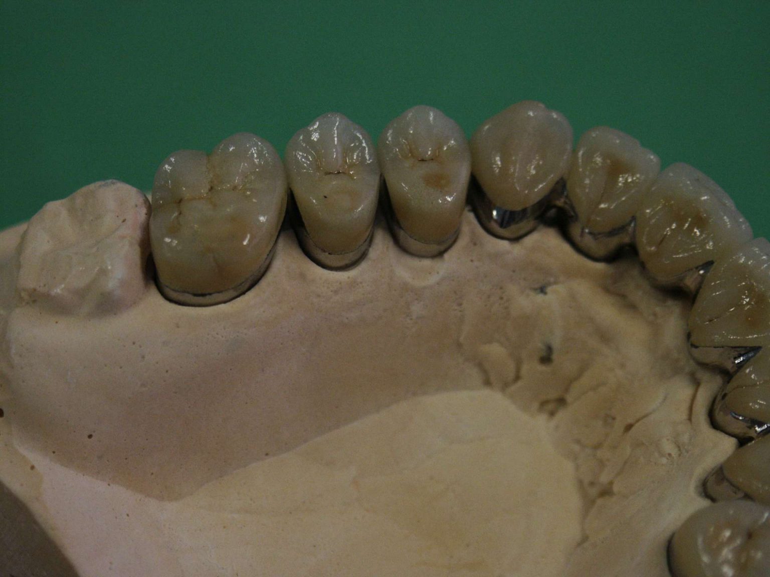 Cera Per Modellazione Dentale Pyrax | Confezione 12 Fogli Da 200g | Uso Protesi E Laboratorio
