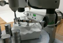 Soluzione overdenture a barra fusa